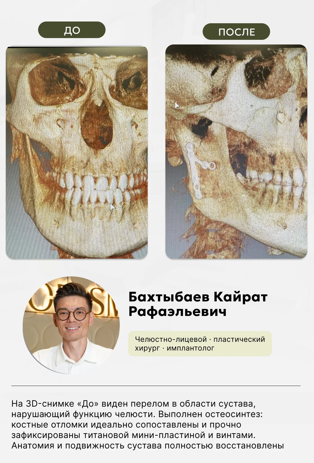 Ювелирная работа нашего хирурга, фото 5
