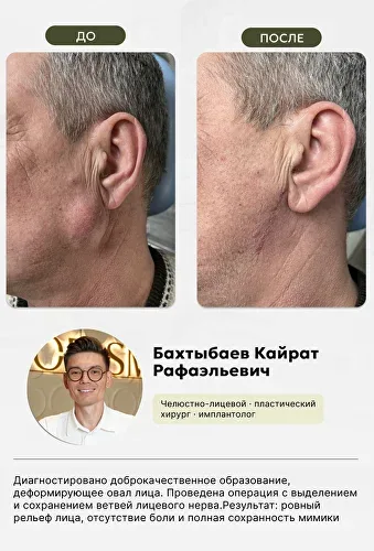 Ювелирная работа нашего хирурга, фото 1