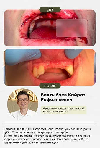 Ювелирная работа нашего хирурга, фото 4
