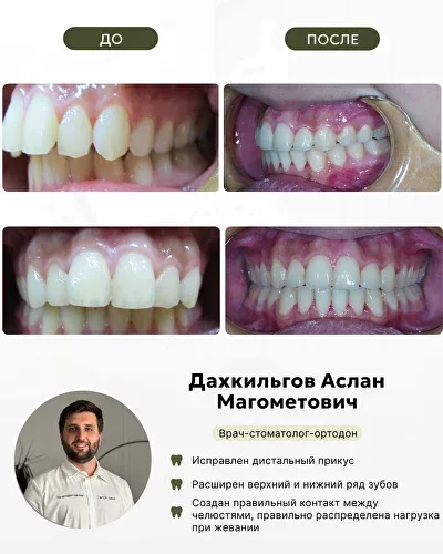 Дахкильгов Аслан магометович, фото 2