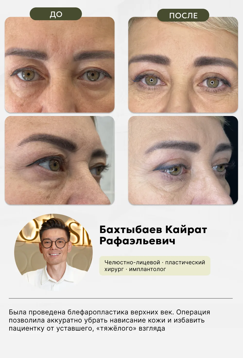 Пластическая хирургия: до и после