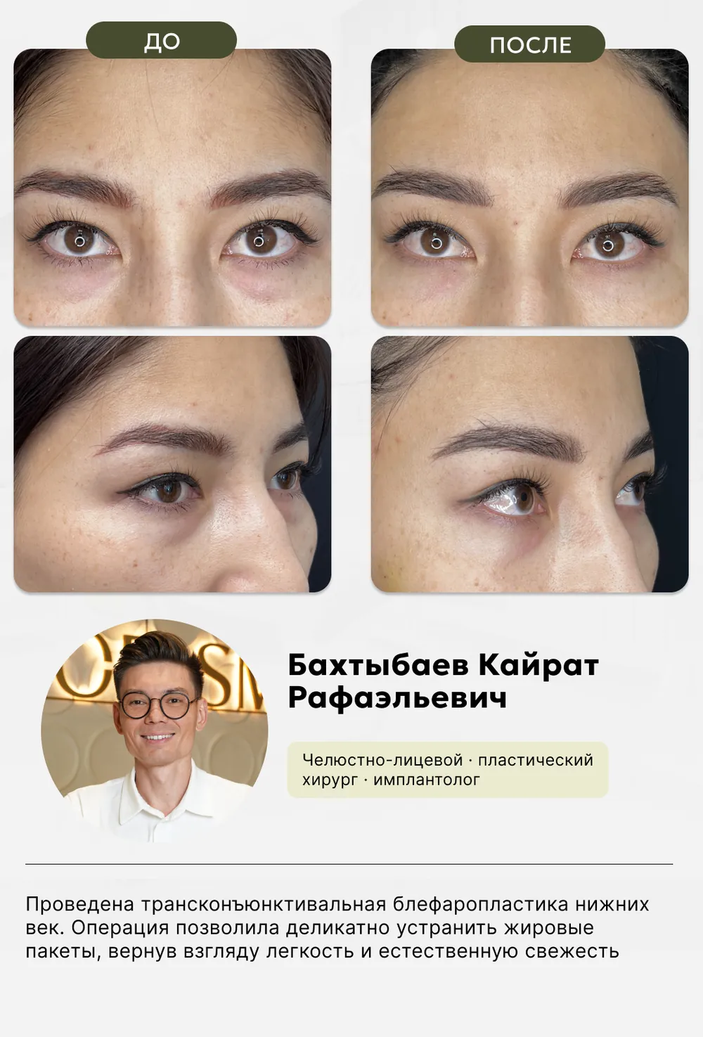 Пластическая хирургия: до и после