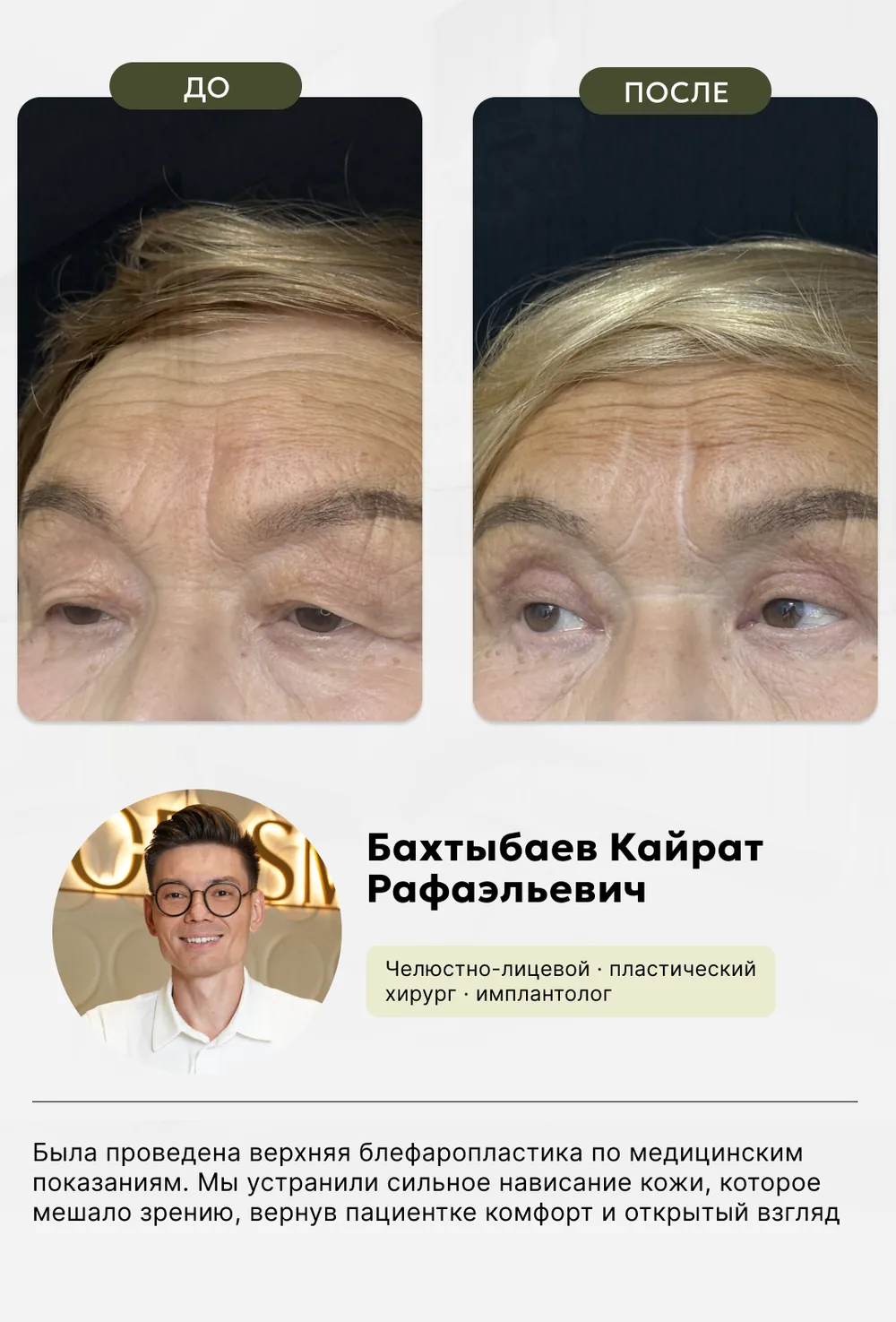Пластическая хирургия: до и после