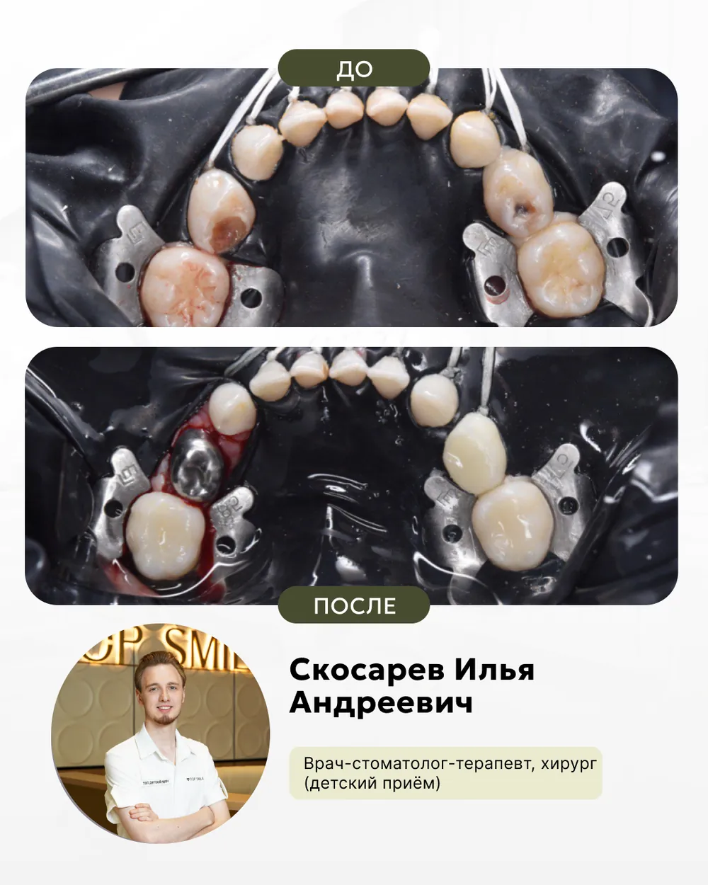 Результат лечения: до и после