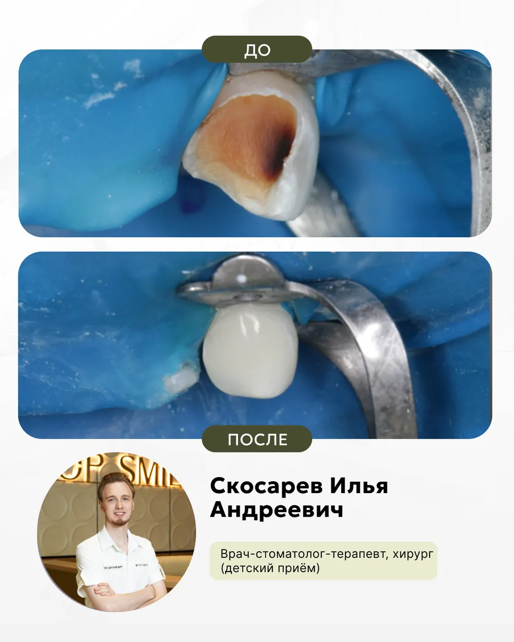 Результат лечения: до и после