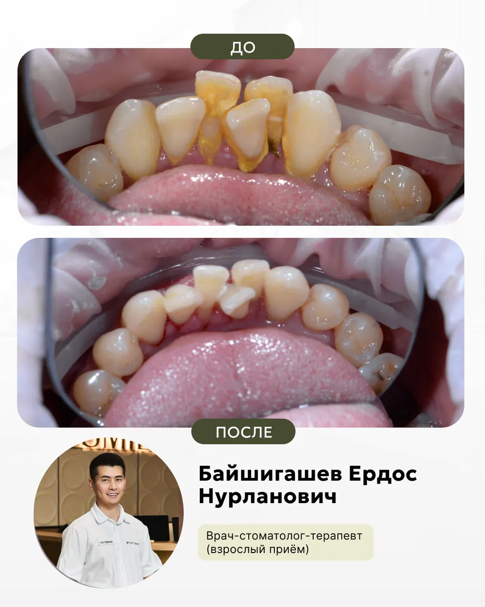 Результат лечения: до и после