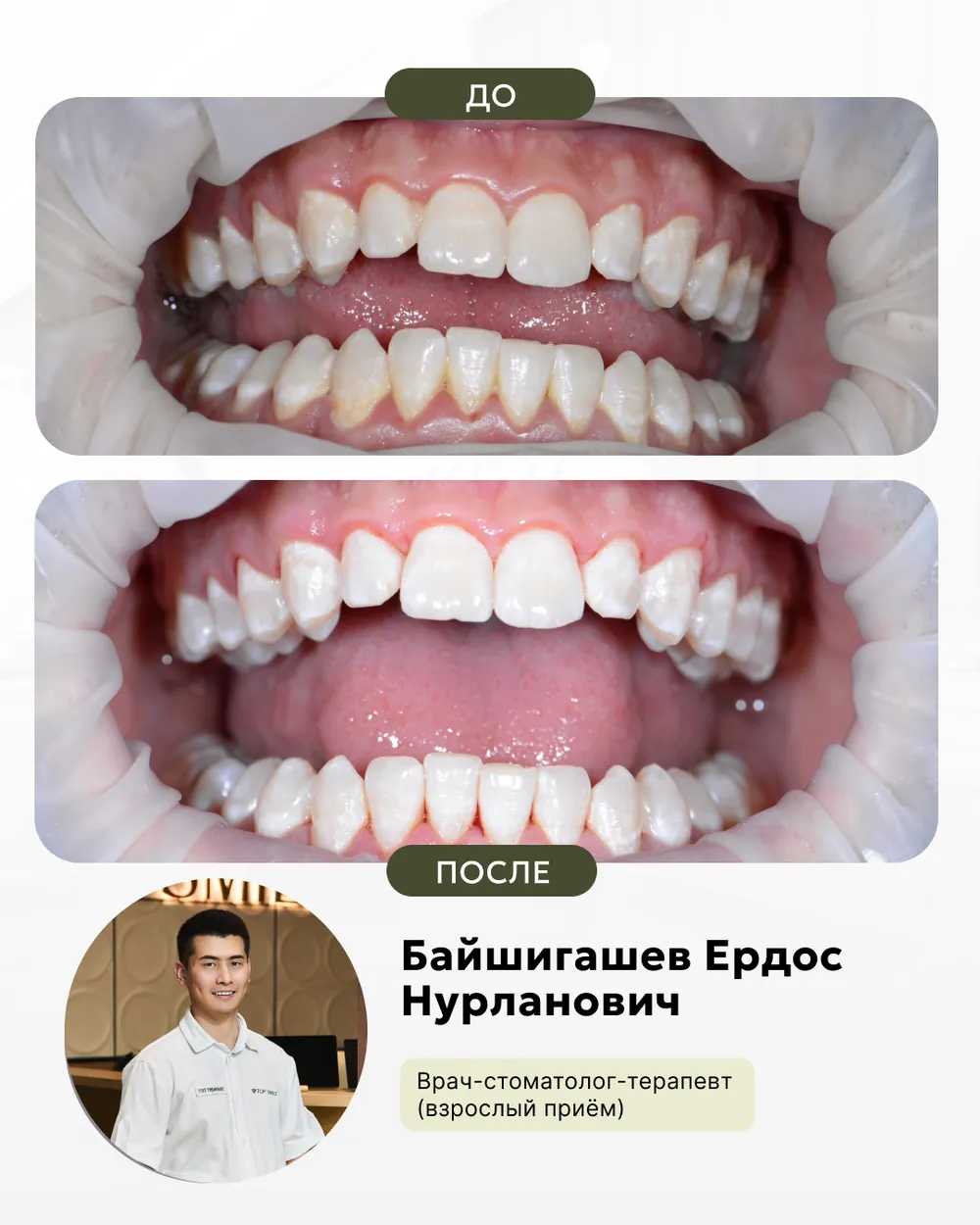 Результат лечения: до и после