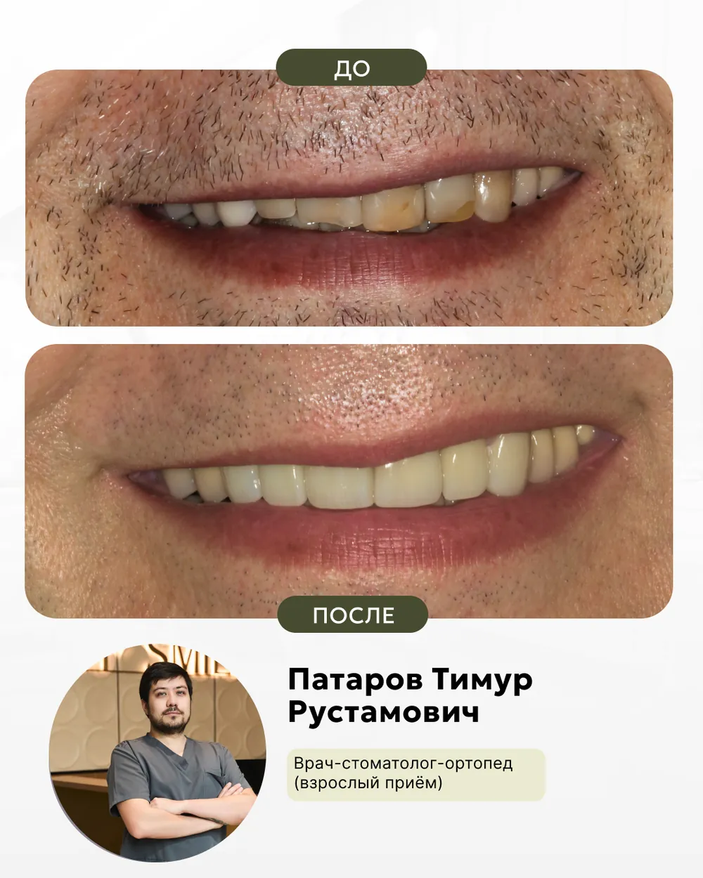 Результат лечения: до и после