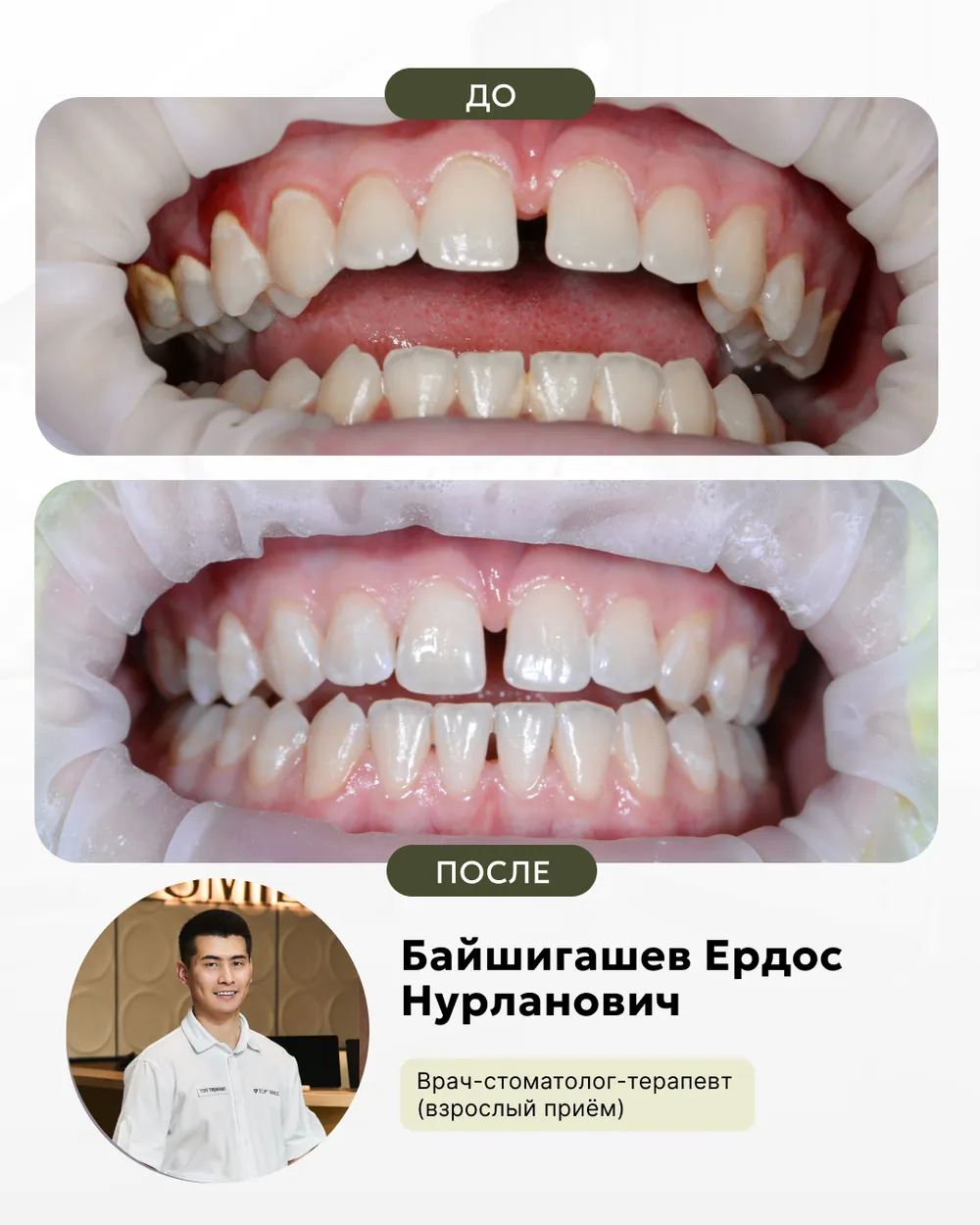 Результат лечения: до и после