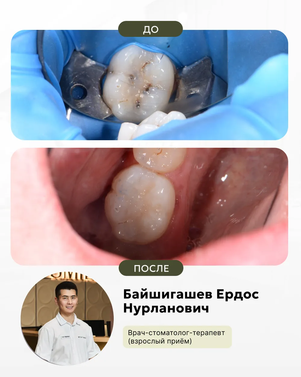 Результат лечения: до и после