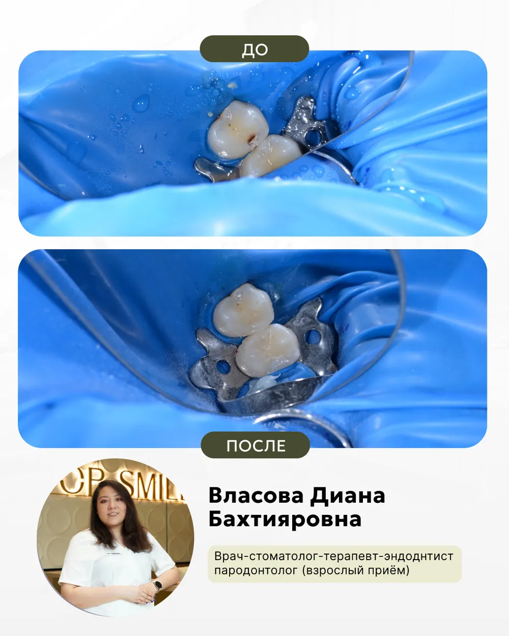 Результат лечения: до и после