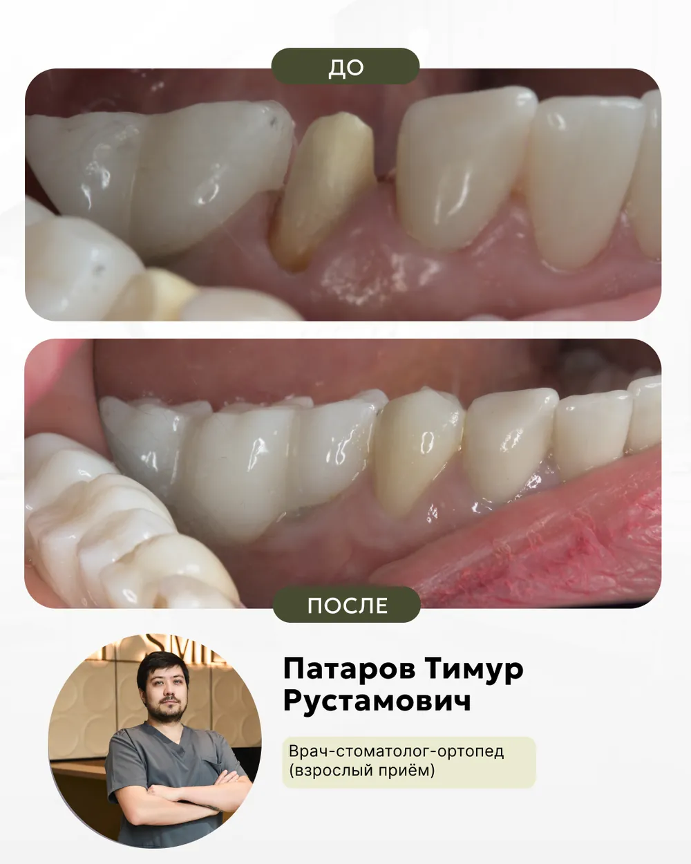 Результат лечения: до и после