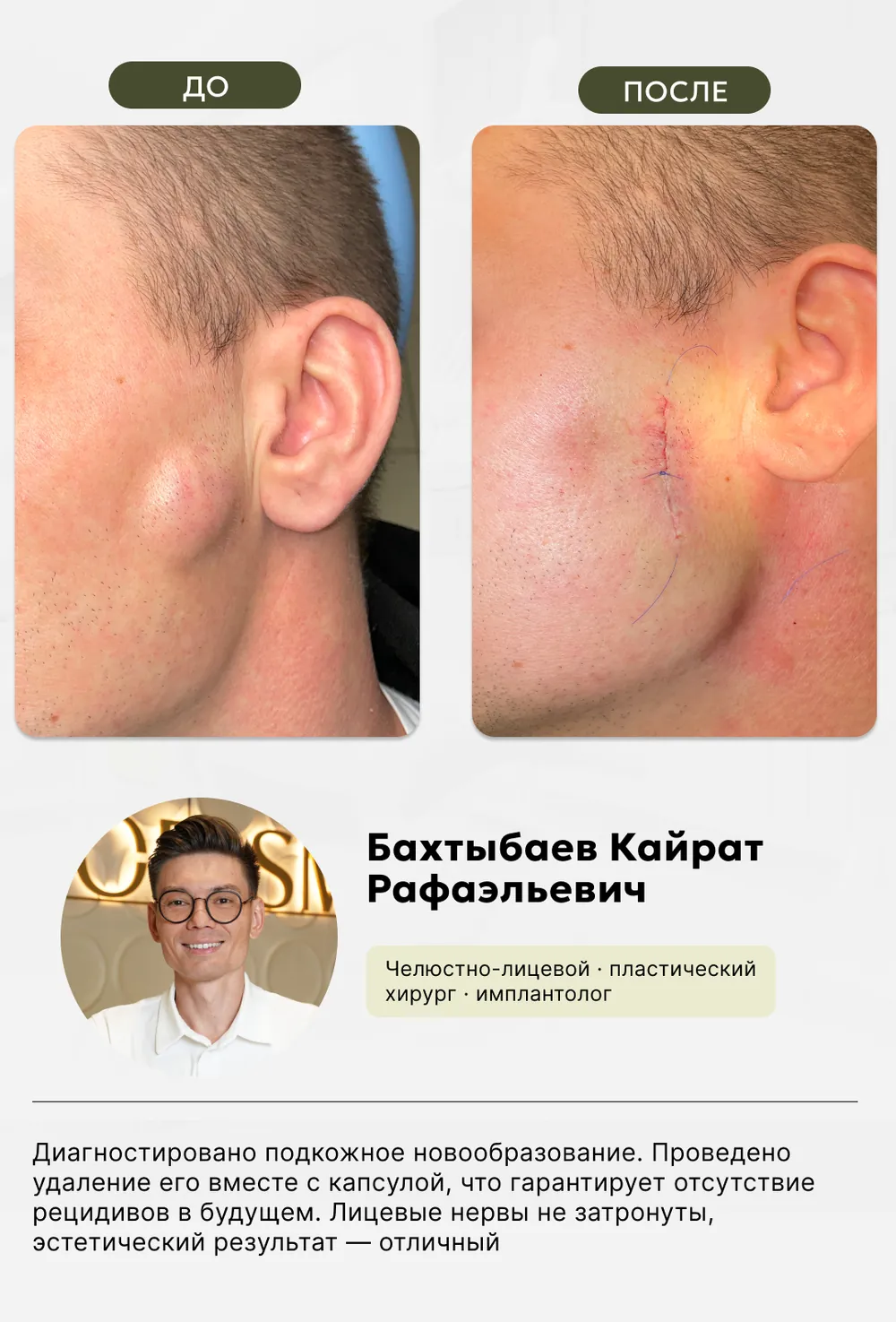 Челюстно-лицевая хирургия: до и после