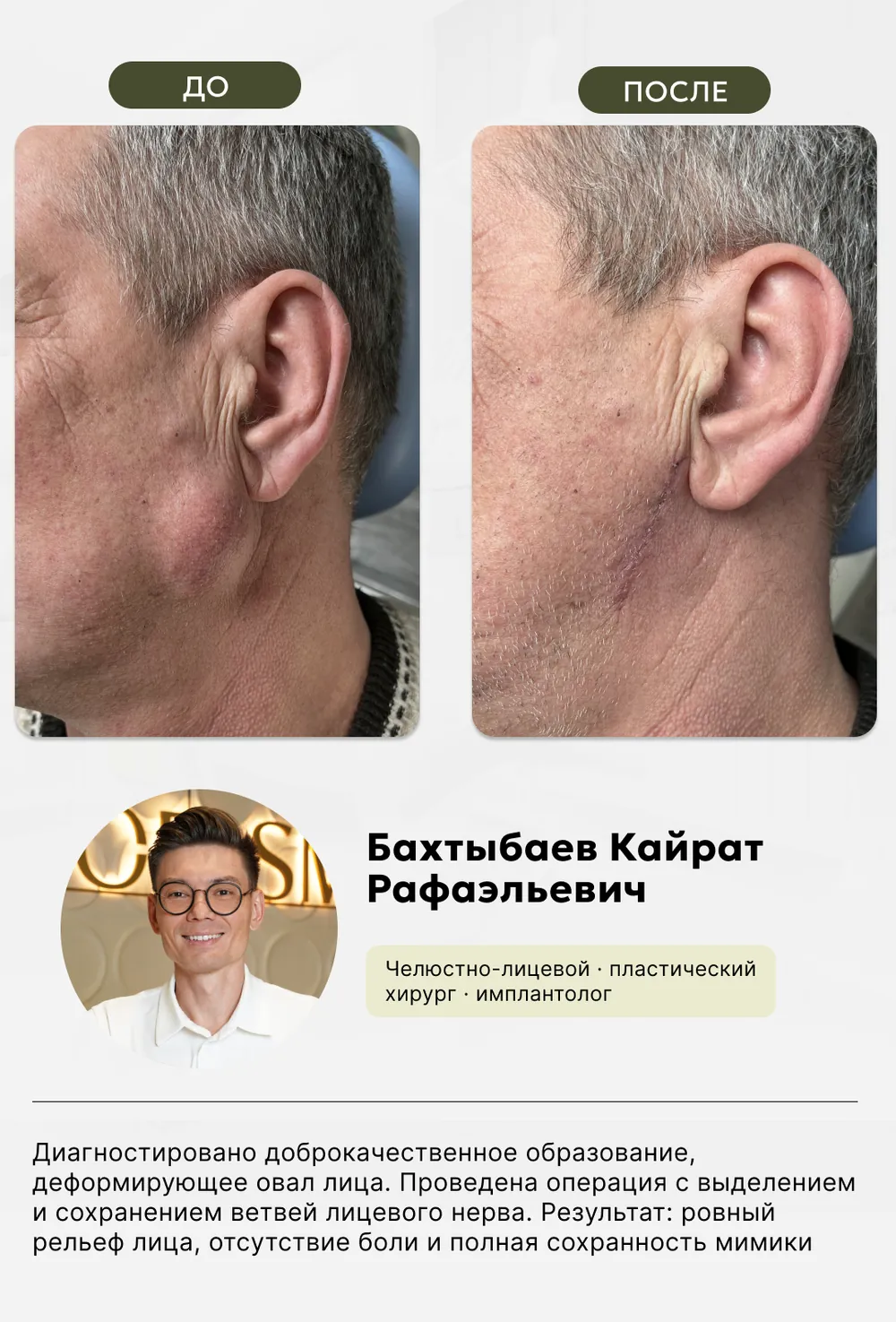 Челюстно-лицевая хирургия: до и после